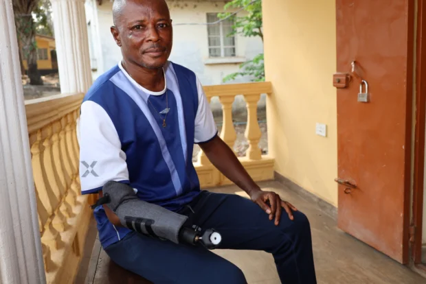 Person with prosthetic arm